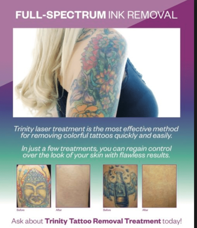 14 Things No One Tells You About Tattoo Removal  Glamour